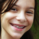 A child with braces